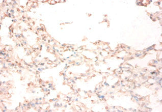 STEAP1 Antibody