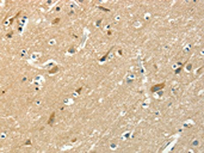 ASAH2 Antibody