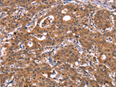 HMGCS1 Antibody