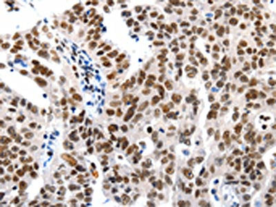 HDAC1 Antibody