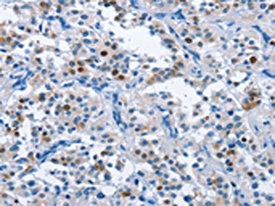 MCM7 Antibody