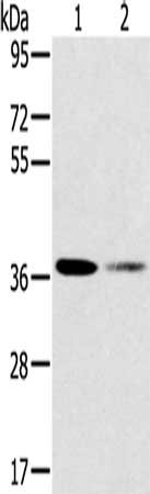 SMN1 Antibody