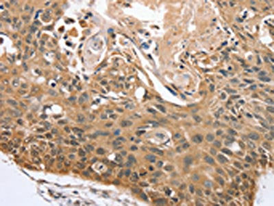 RBM38 Antibody