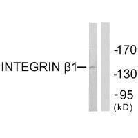 ITGB1 (Ab-789) Antibody