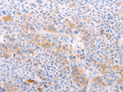 S1PR4 Antibody