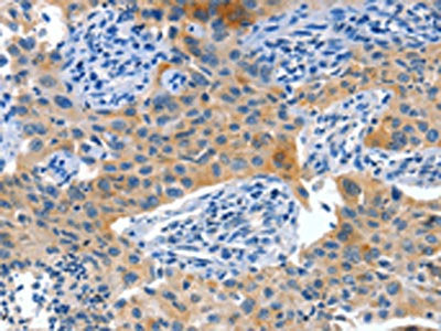 ALPP Antibody