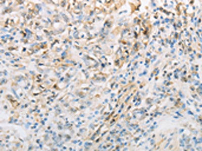 NPPC Antibody