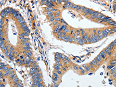 HSPA1A Antibody