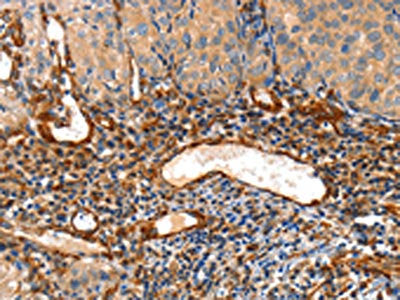 AIFM3 Antibody