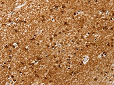 SSX4 Antibody