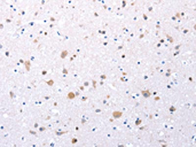 CCKAR Antibody