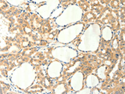 TRPM5 Antibody
