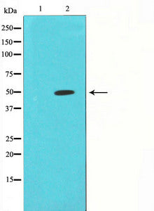 FOS Antibody