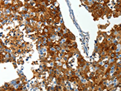 ABCG1 Antibody