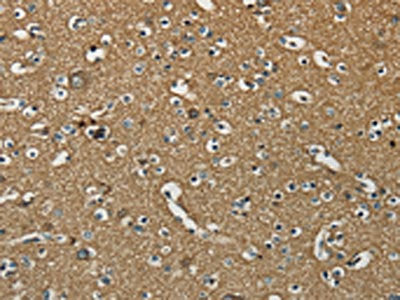 NEMF Antibody