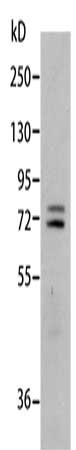 MMP2 Antibody