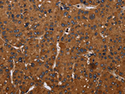 CYBB Antibody