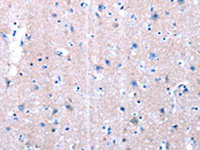 LAMA3 Antibody