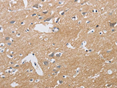 KCNMB3 Antibody