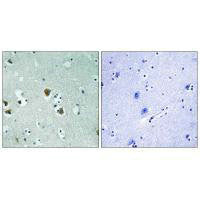DPYSL2 (Ab-509) Antibody
