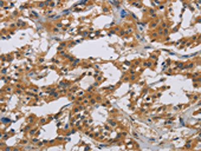 IL18R1 Antibody