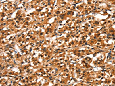 DDX4 Antibody