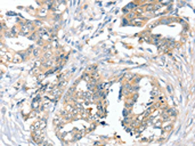SLC9A9 Antibody