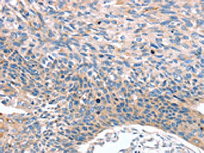 MUC1 Antibody