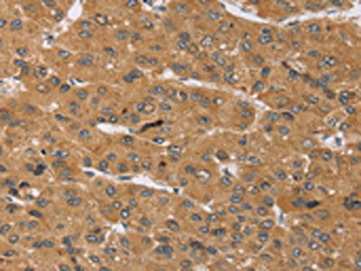 KCNJ15 Antibody