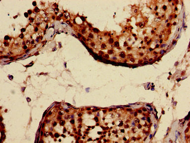 CRAT Antibody