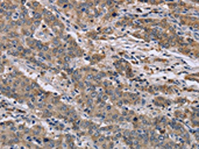 GSN Antibody