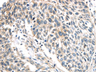 IQGAP2 Antibody