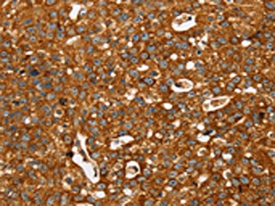 STK32A Antibody