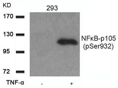 Phospho-NFKB1 (Ser932) Antibody