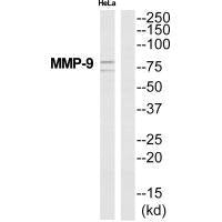 MMP9 Antibody