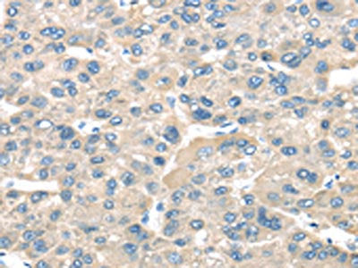 TNFAIP8 Antibody