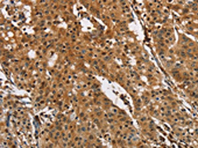 PTK6 Antibody