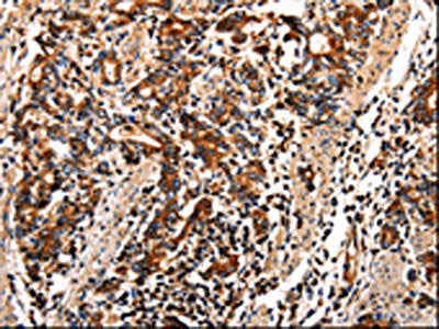 TTR Antibody