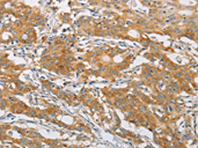 FARSB Antibody