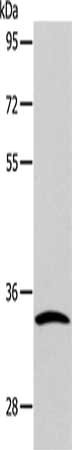 CASP6 Antibody