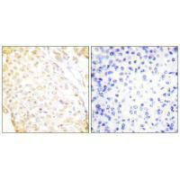 NKX3-1 Antibody