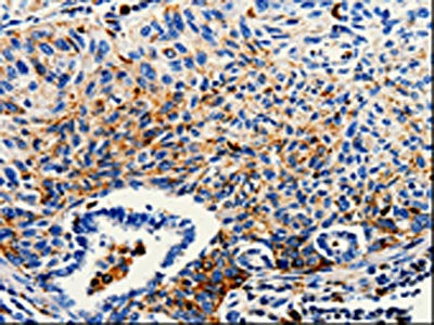 CTSZ Antibody