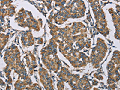 HDAC6 Antibody
