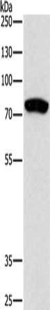 PRKCB Antibody