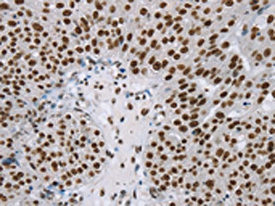 ZMIZ1 Antibody