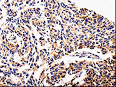 AFP Antibody