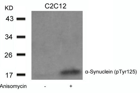 Phospho-SNCA (Tyr125) Antibody