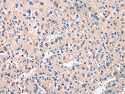 CTSK Antibody
