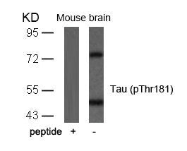 Phospho-MAPT (Thr181) Antibody
