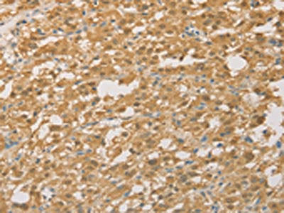 PGK2 Antibody